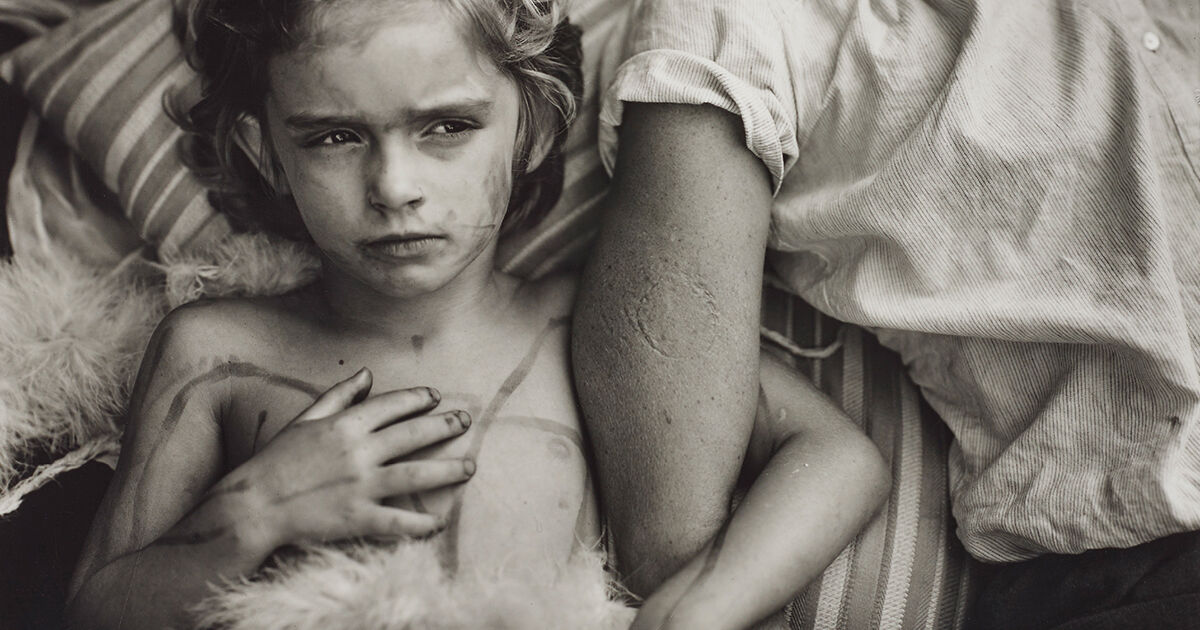 nude photography sally mann 1 Why Sally Mann's Photographs of Her Children Can Still Make Viewers Uncomfortable | Artsy
