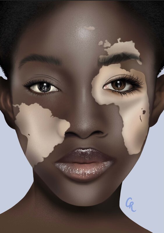 Brown Eyes Vitiligo Face Brown Skin Tone's Code & Price - RblxTrade