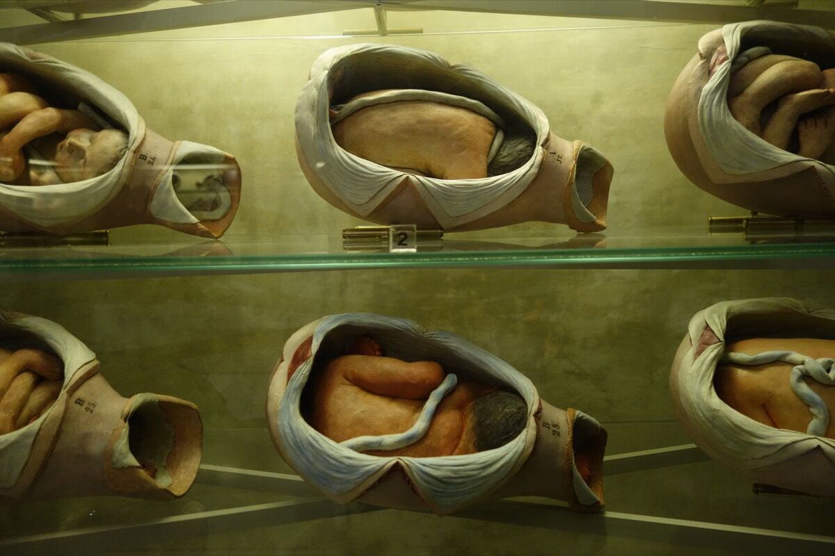 Wax wombs at the Museo di Palazzo Poggi Anatomy & Obstetrics. Photo by Geoffrey Rockwell, via Flickr.