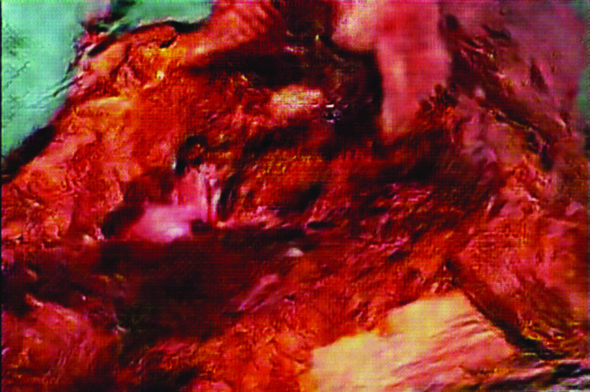 Detail of Harshit Agrawal, The Anatomy Lesson of Dr. Algorithm, 2018. Courtesy of Nature Morte, New Delhi.