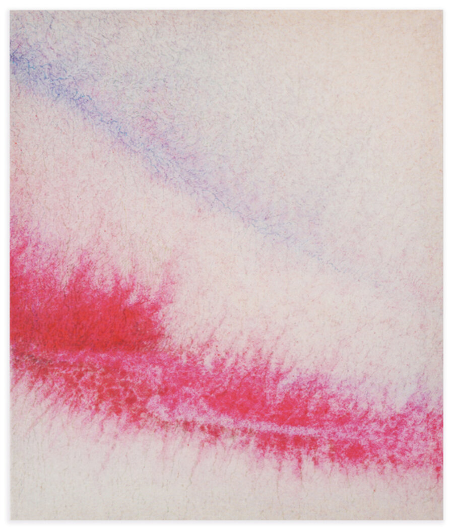Bruise Series, #82.4 Million, *82.4 million displaced people worldwide