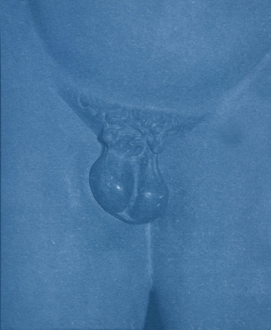 To Emasculate, 1915
