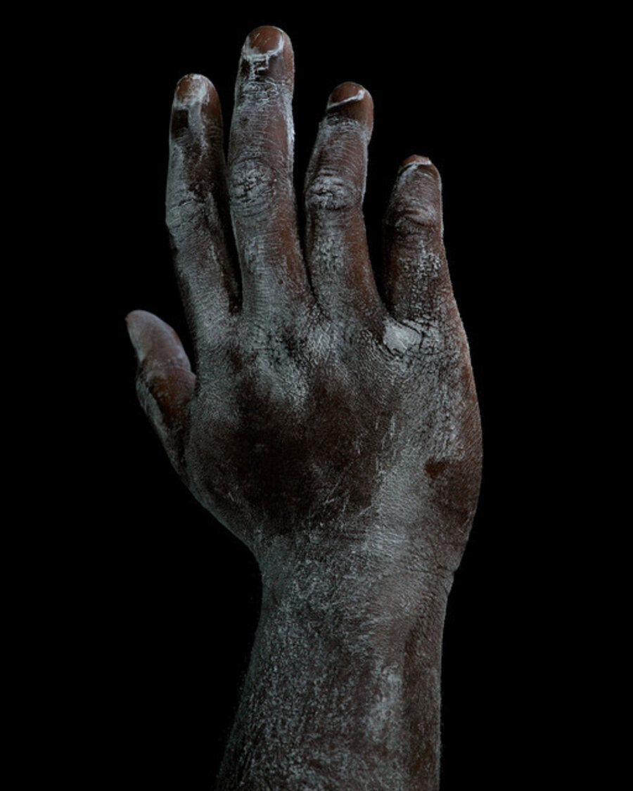 Tunnelitis #1