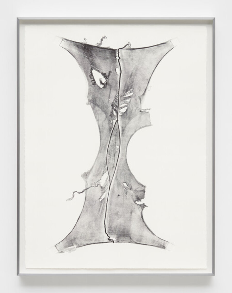 Expanded X, From the series Expanded, In Treatment