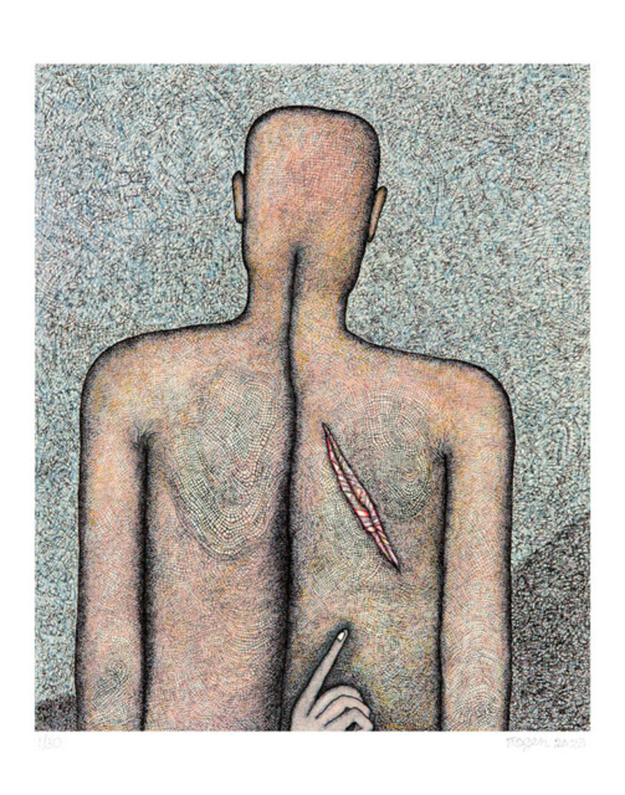 Wound