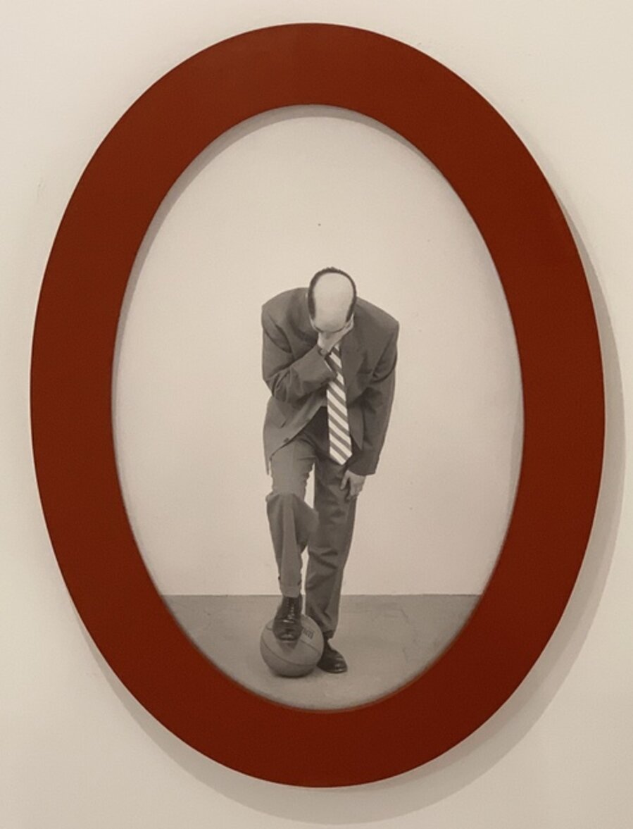 Male Pattern Baldness (Variation No.2)
