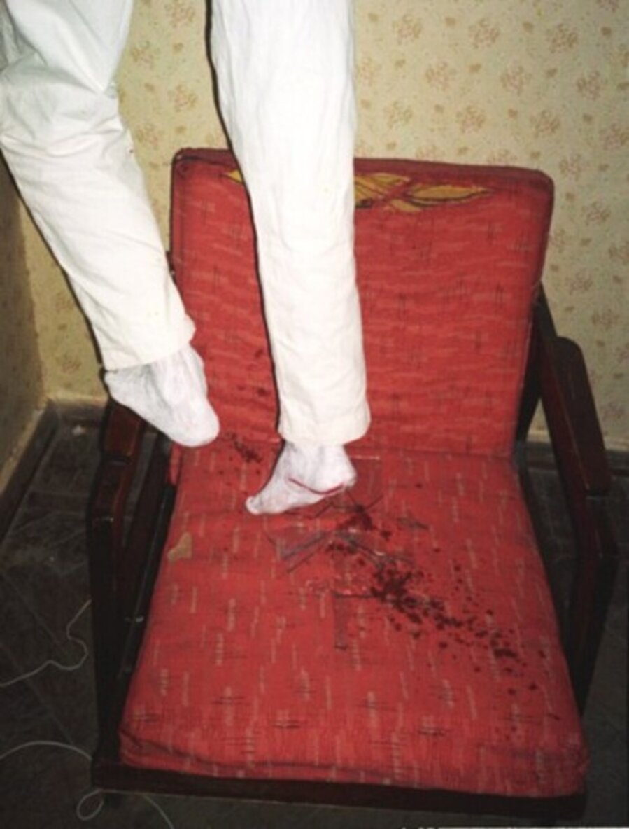 Dream about double Killing (legs)