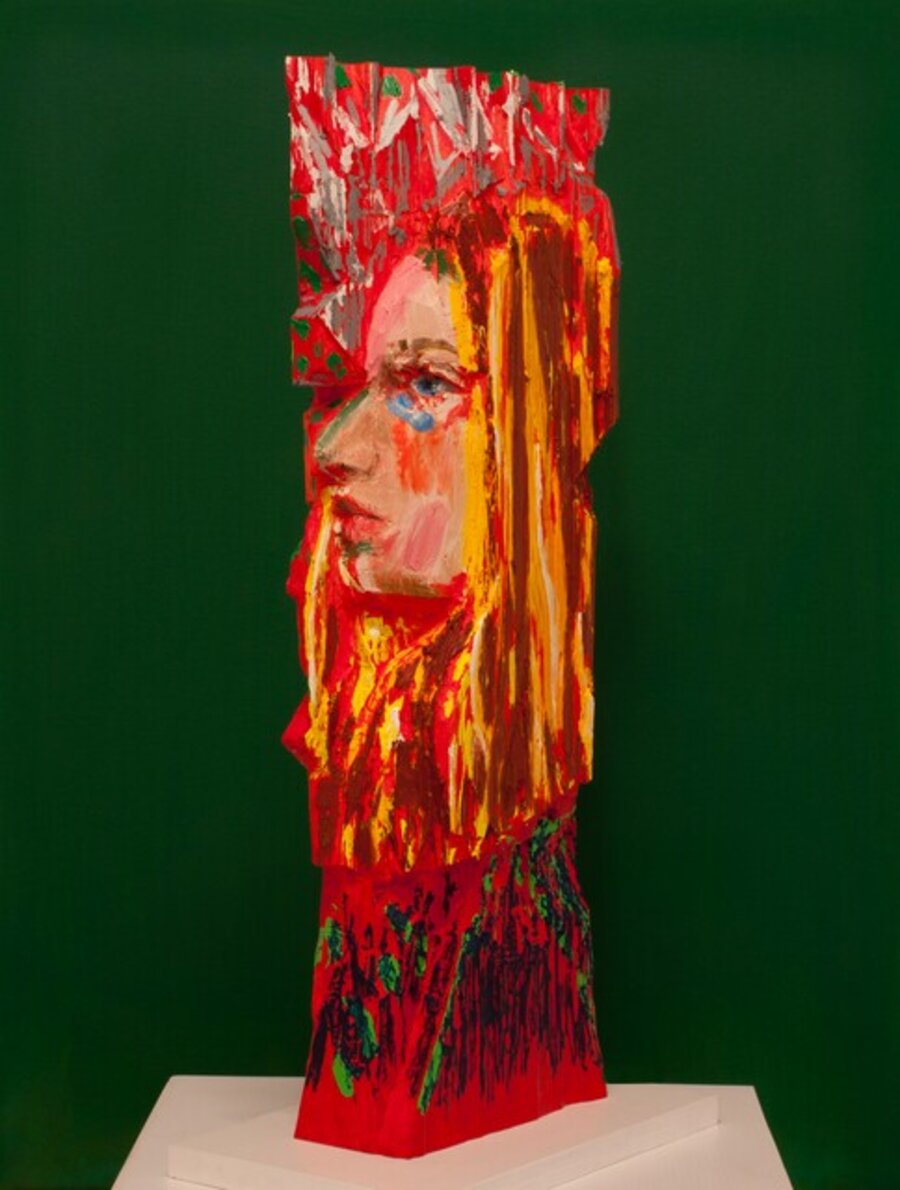 Woman with Scinitllating Scotoma
