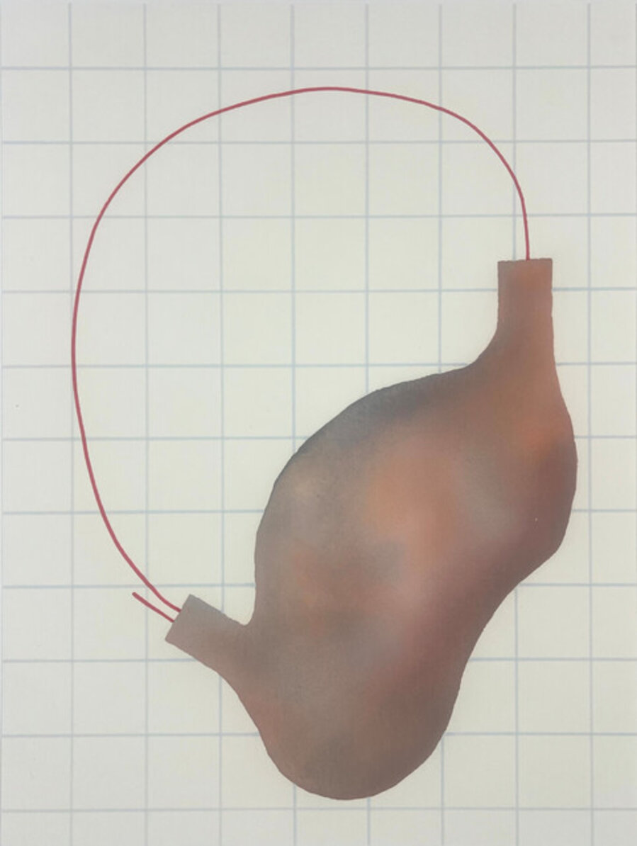 Filter Resonance 1