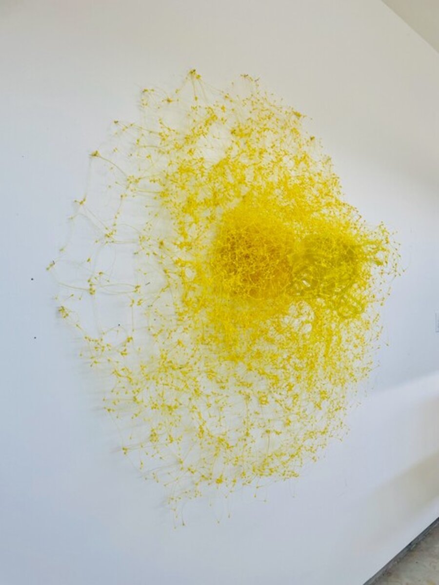 Varicella Zoster
