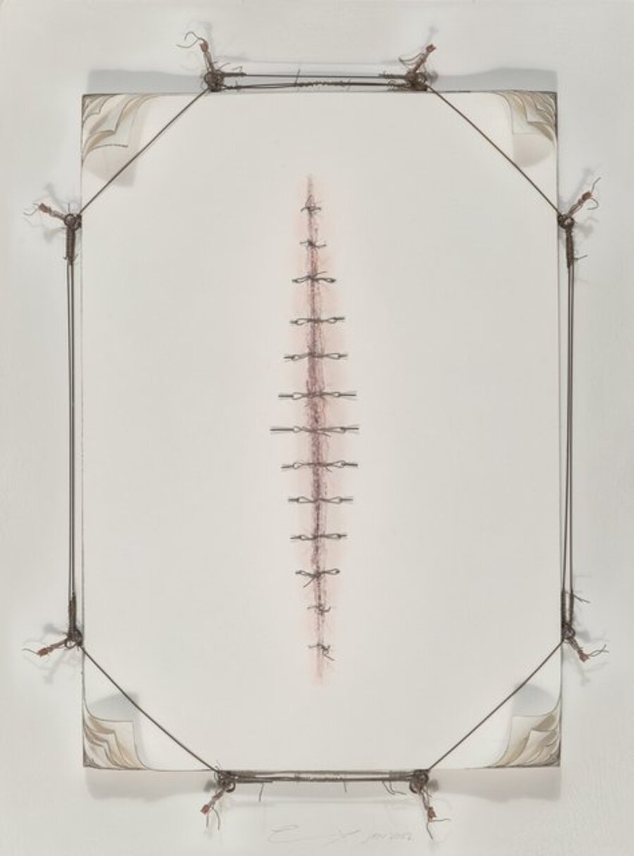 Wound Drawing No. 1