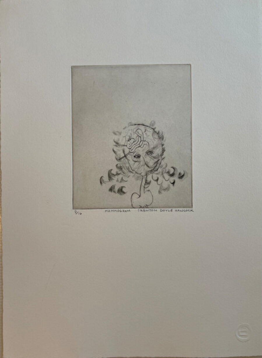 Mammogram
