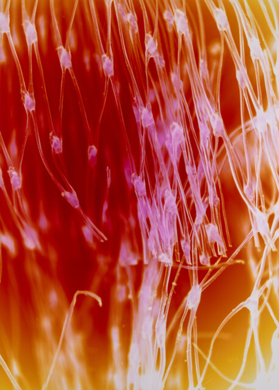 Synapse, 15:23