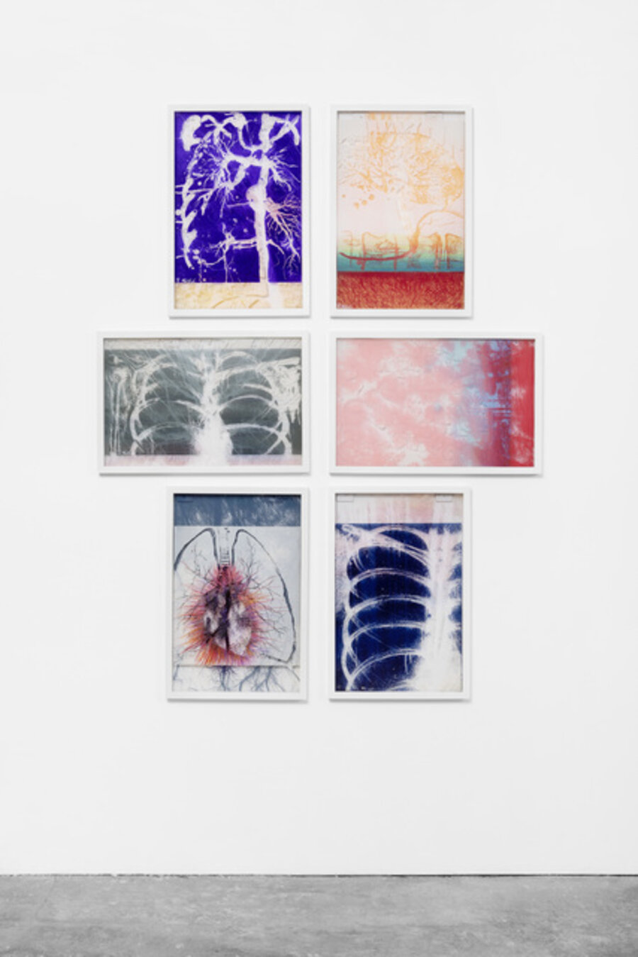 X-Rays of Sunlight (Collection of 6 works)