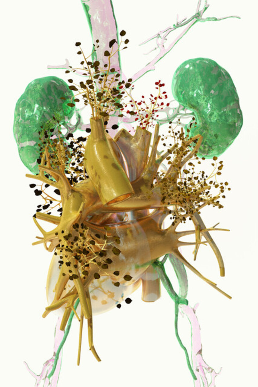 AORTA 05