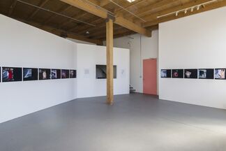 Love on the Left Eye, installation view