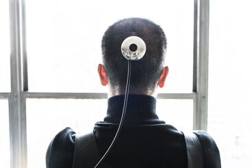 Wafaa Bilal, ‘3rdi (implanted camera)’, 2010