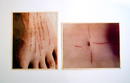 Gina Pane, ‘Cicatrice de l'action (Le corps pressenti, Psyché)’, 1974-1975