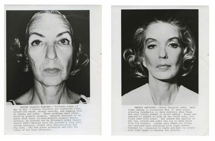 Murray Moss, ‘TQ 61/62: Plastic Surgery, Before and After’, 1971/1971