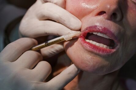 Lauren Greenfield, ‘Dermatologist Dr. Arnold Klein, 81, dubbed "the King of Lips," injects "the Pink Lady" Jackie Goldberg, 72, with collagen, Beverly Hills’, 2005