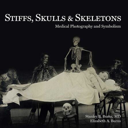 Burns Archive, ‘Stiffs, Skulls & Skeletons: Medical Photography and Symbolism’, 2016
