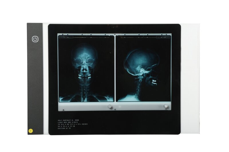 Damien Hirst, ‘Self Portrait X-Ray’, 2008, Mixed Media, Two rayographs and light box, Chiswick Auctions