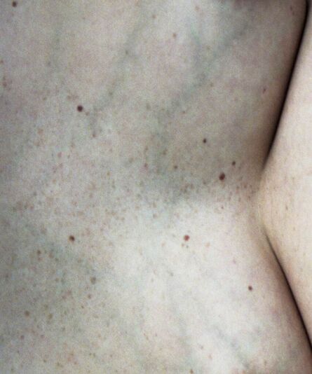 Mia Dudek, ‘Untitled III [skin studies]’,  2019