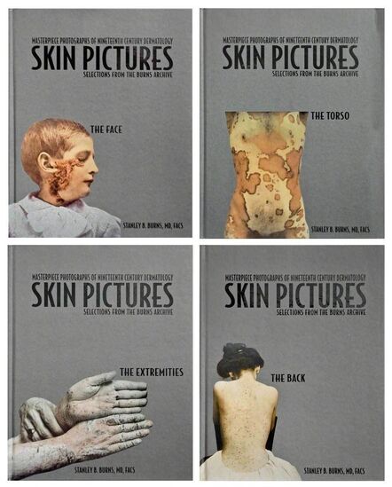 Burns Archive, ‘Skin Pictures: Masterpiece Photographs of Nineteenth Century Dermatology’, 2005