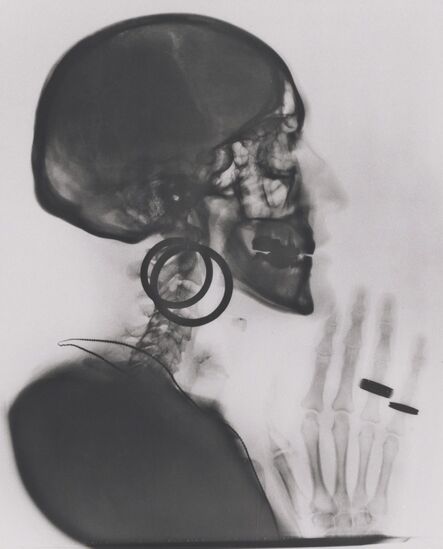 Méret Oppenheim, ‘X-ray of My Skull’, 1964; printed 1981