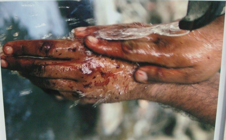HAND WASHES BLOOD
