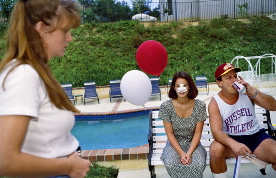 Lindsey, 18, at a Fourth of July party three days after her nose job, Calabasas, California