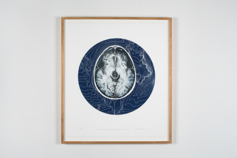 R.C. Roads, Spaces, Alan Waters Shape, Brain Scan