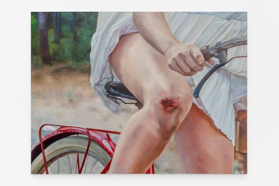 Skinned Knee