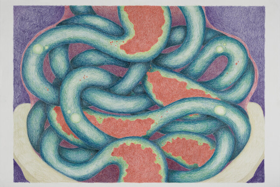 Lower Digestive
