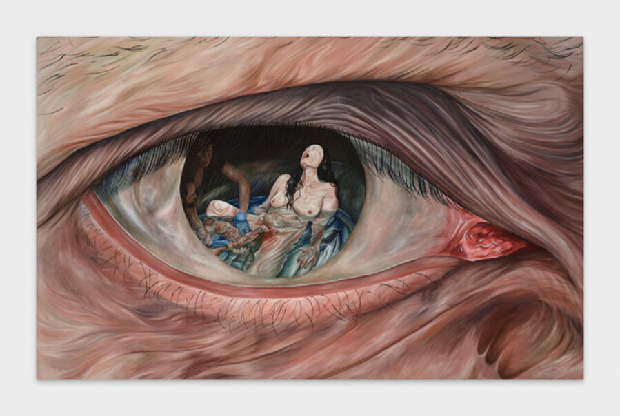 Eye (Birth)