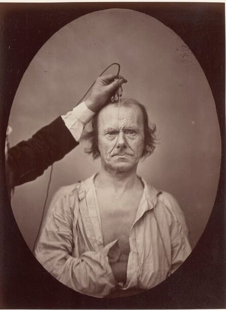 Guillaume Benjamin Armand Duchenne de Boulogne, ‘Old Man showing 'Muscle of Aggression'’, 1855-56