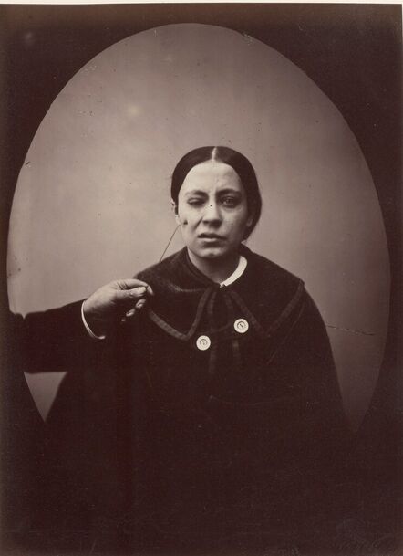 Guillaume Benjamin Armand Duchenne de Boulogne, ‘Young Woman showing Muscle of Weeping from 'Mecanisme de la Physionomie Humaine’, 1855-56