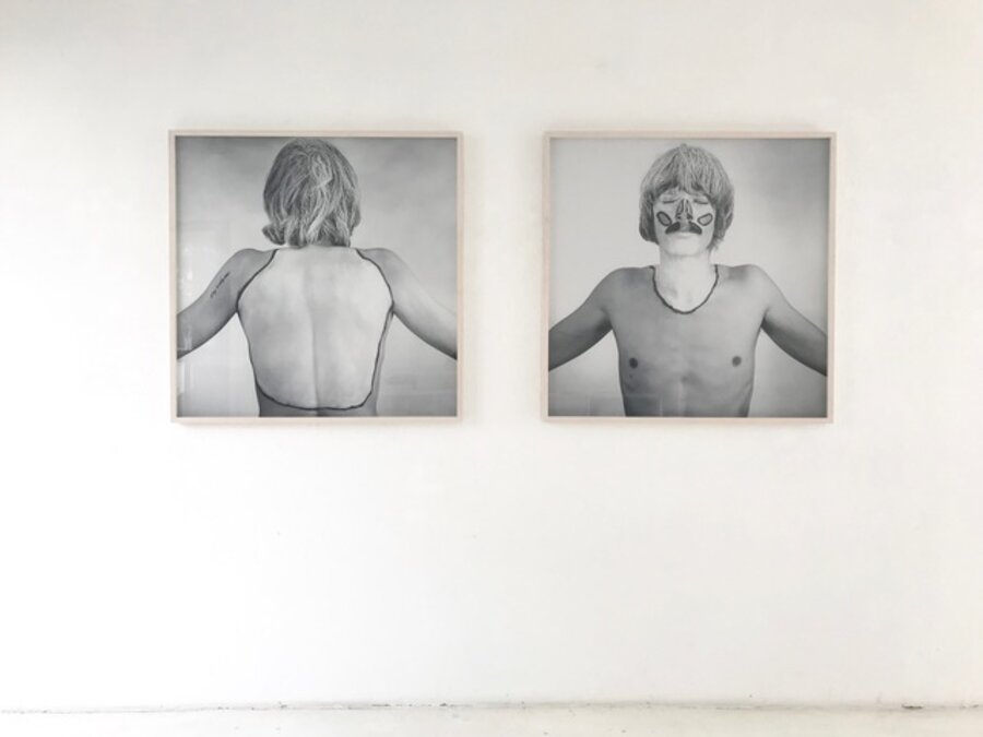 THE WHITE SPOTS OF MY BODY LANDSCAPE /DIE WEIßEN FLECKEN MEINER KÖRPERLANDSCHAFT