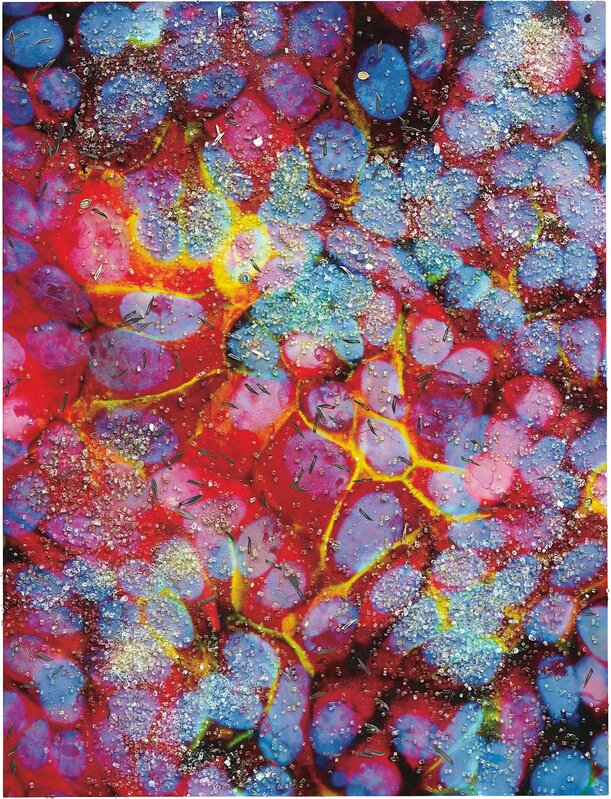 Damien Hirst, ‘Second Series Biopsy: M122/105-Breast_cancer_cells,_immunofluorescent_light_micrograph-SPL.jpg’, 2008, Mixed Media, Uv inks and household gloss on canvas with glass, scalpel blades, flocking and religious medals, Phillips
