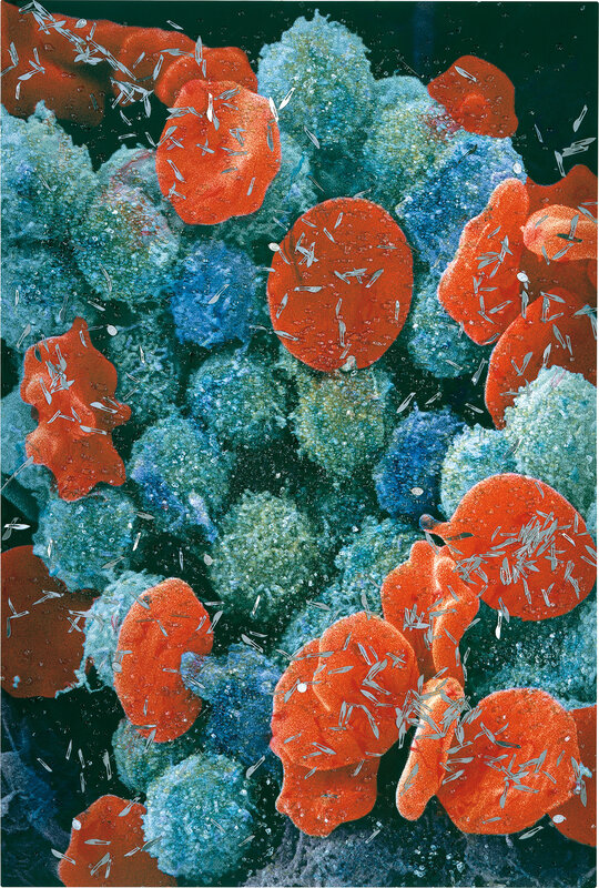Damien Hirst, ‘Second Series Biopsy: M132/655-Leukaemia_blood_cells,_scanning_electron_micrograph-SPL.jpg’, 2008, Mixed Media, Inkjet print and household gloss on canvas with glass, blades and religious artefacts, Phillips