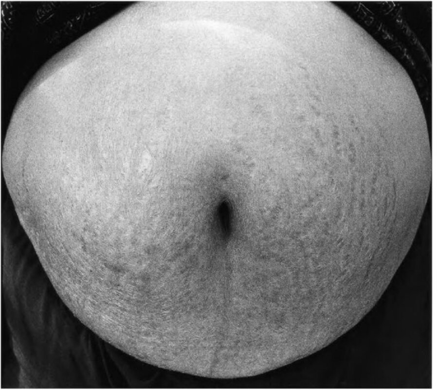 NOTES TO THE BODY