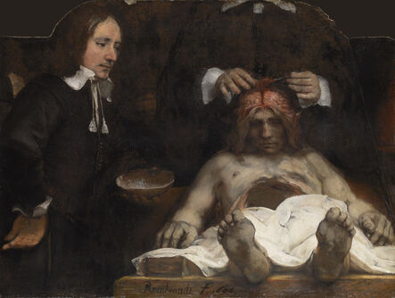 Rembrandt van Rijn, ‘The Anatomy Lesson of Dr Joan Deyman’, 1656