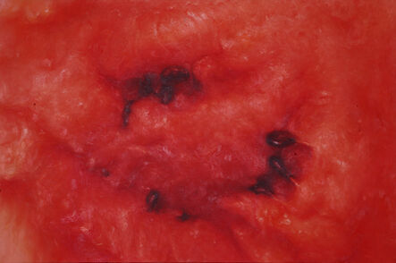 LIYONG LIU, ‘Watermelon no.3’, 2009