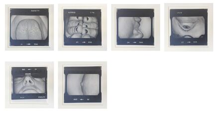 Jo Spence, ‘Body Parts’, 1978