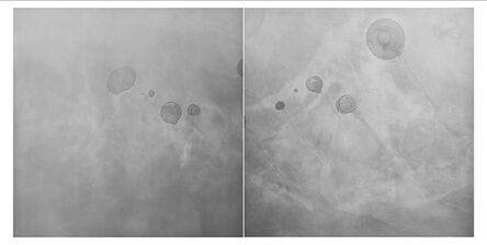 Gen Aihara, ‘Composition of Air 0118 (diptych) ’, 2008