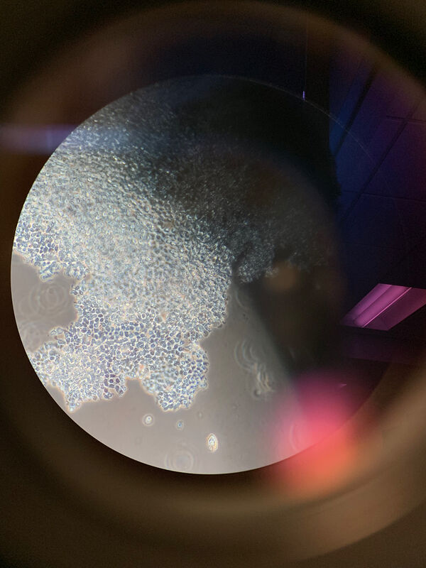 Heather Dewey-Hagborg, ‘Jurkat Cells Brightfield 40x Magnification and Eyepiece Lens’, 2019, Photography, Archival pigment print mounted on dibond, Fridman Gallery
