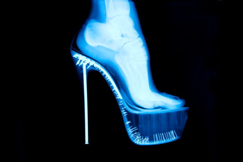 Tyler Shields, ‘X-Ray High Heel’, 2012, Photography, Chromogenic Print on Kodak Endura Luster Paper, Isabella Garrucho Fine Art