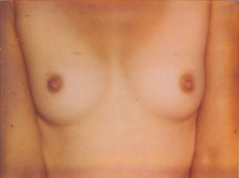 Stefanie Schneider, ‘Small Breasts (Strange Love) analog, mounted ’, 2006, Photography, Analog C-Prints, hand-printed by the artist, mounted on Aluminum with matte UV-Protection, based on 2 original Polaroids, Instantdreams