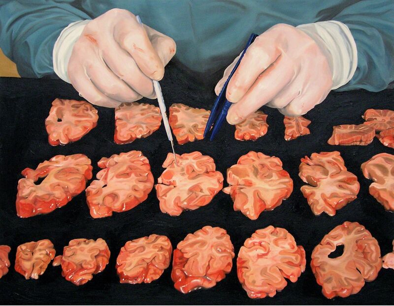 Damien Hirst, ‘Autopsy with Sliced Human Brain’, 2004, Painting, Oil on canvas, The Broad