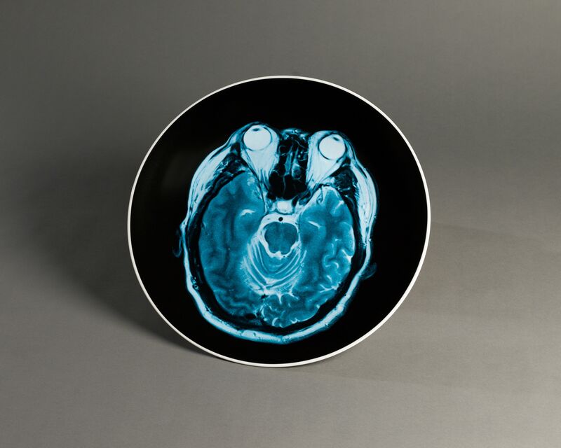 Ai Weiwei, ‘Brain Inflation on Plate, two plates’, 2012, Other, Porcelain, Public Art Fund Benefit Auction
